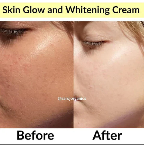 Zafrani Glow whitening cream