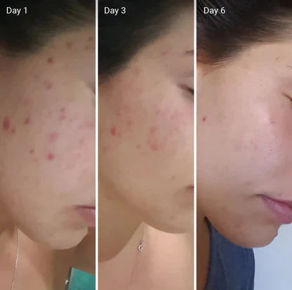 Zafrani Glow whitening cream